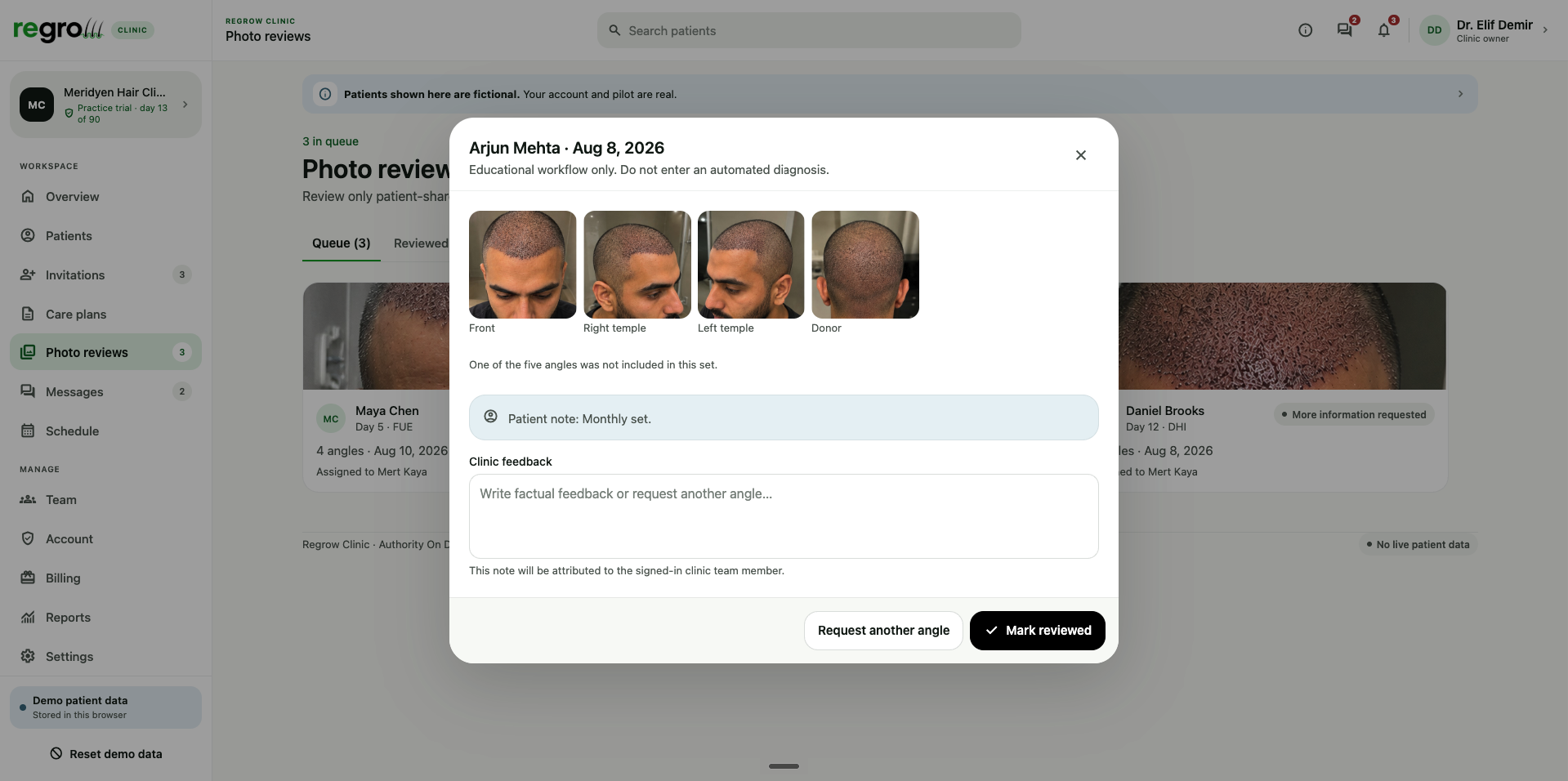 Regrow clinic photo review modal showing four labelled angles for a demonstration patient