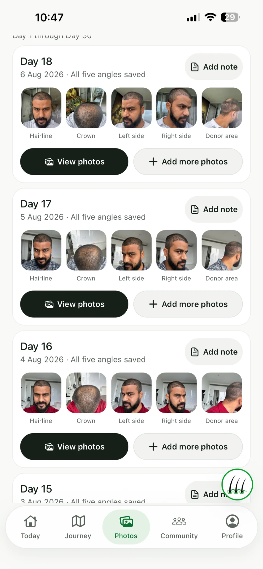 Regrow photo history showing five labelled angles for each day